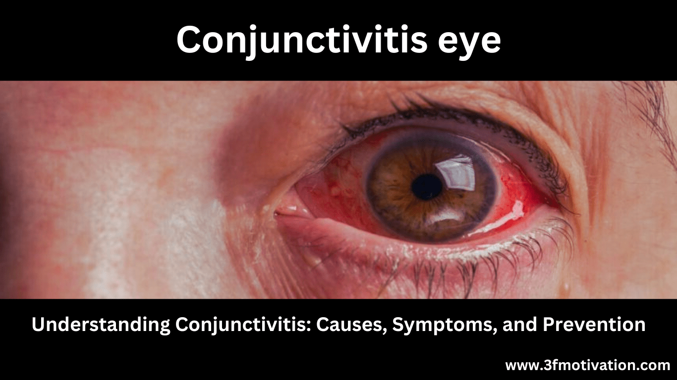 Understanding Conjunctivitis Causes Symptoms And Prevention 