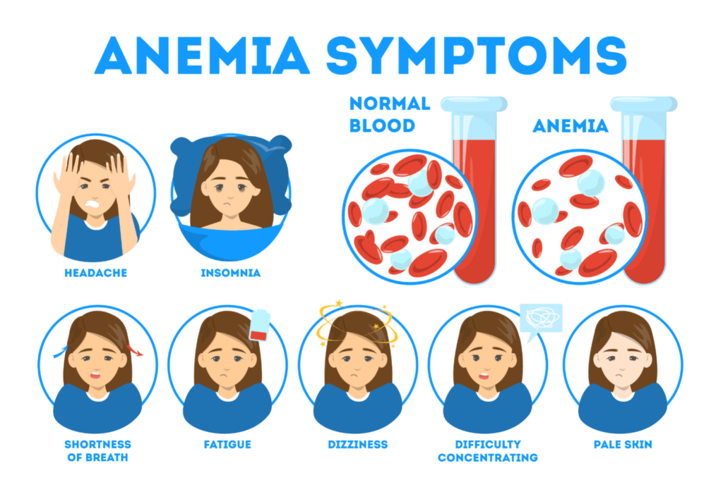 Anemia Symptoms Causes And Treatment 0122